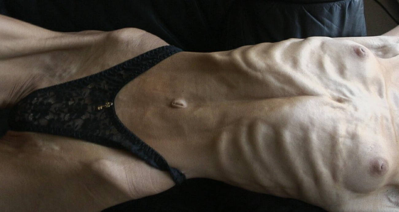 Sonja skinnyfans